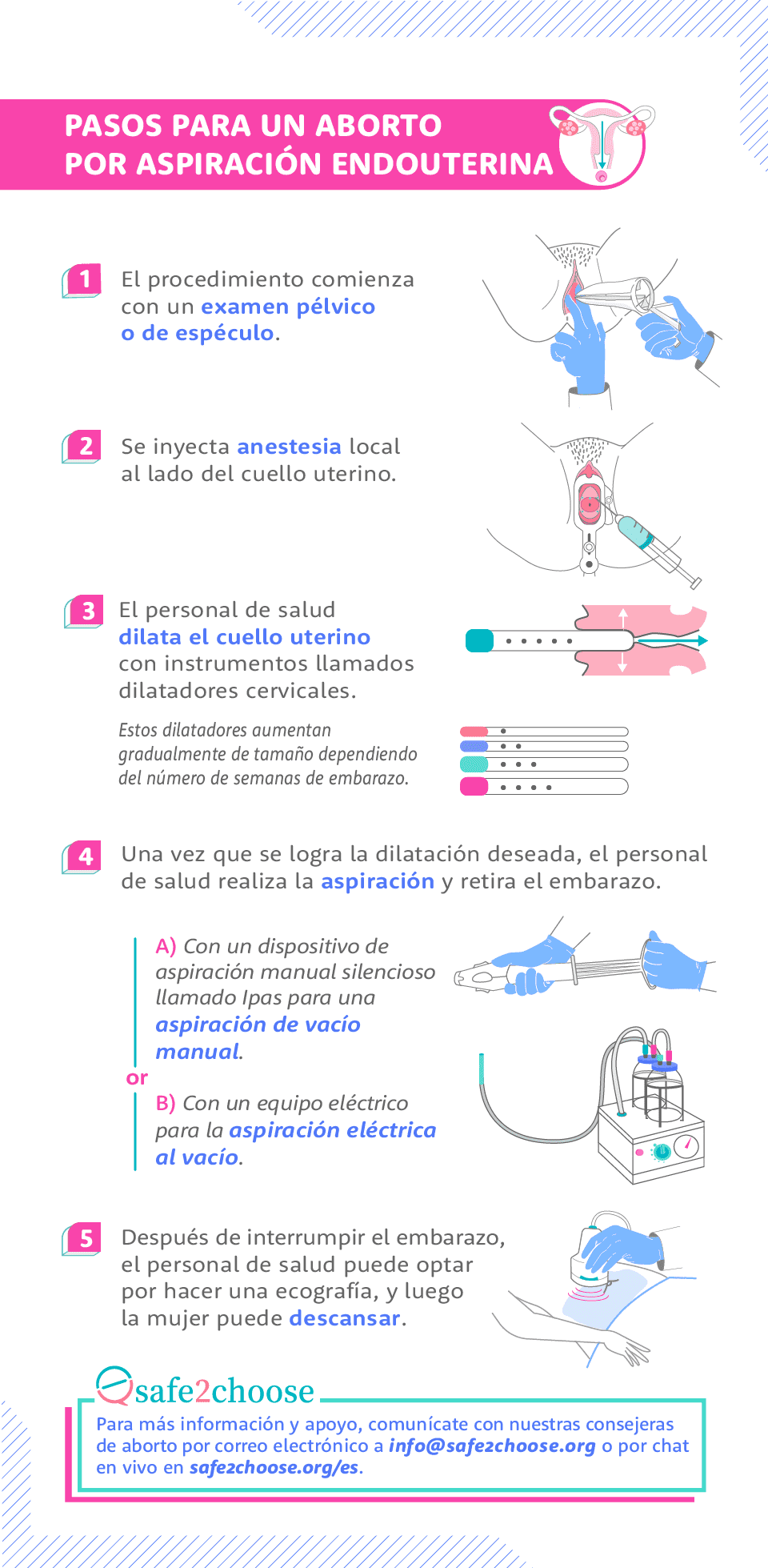 pasos aborto aspiracion al vacio